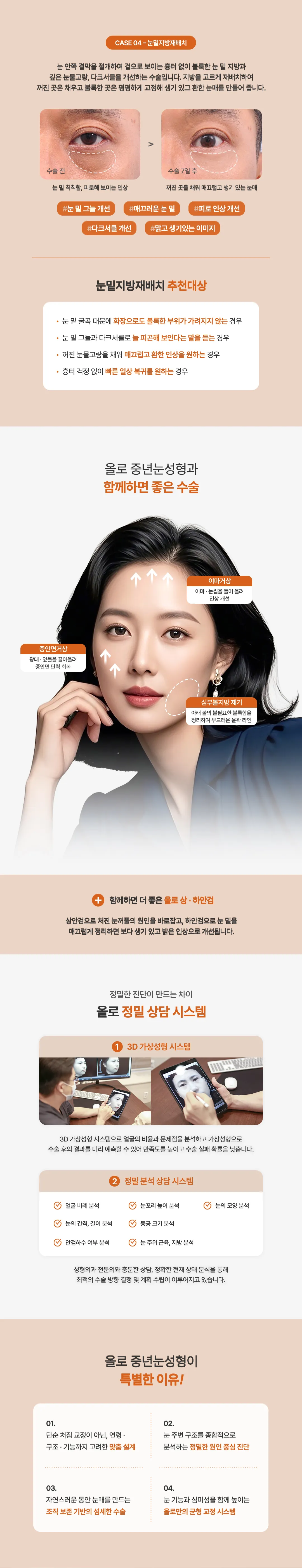 올로 중년눈성형 추천대상